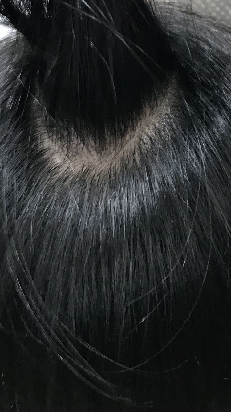 21E0197E-5143-48B8-9EB0-1F96B92F23AA.png