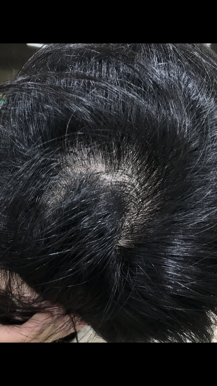 D7791C6C-1AC6-4A0F-AE3B-04AFAE012EC6.png