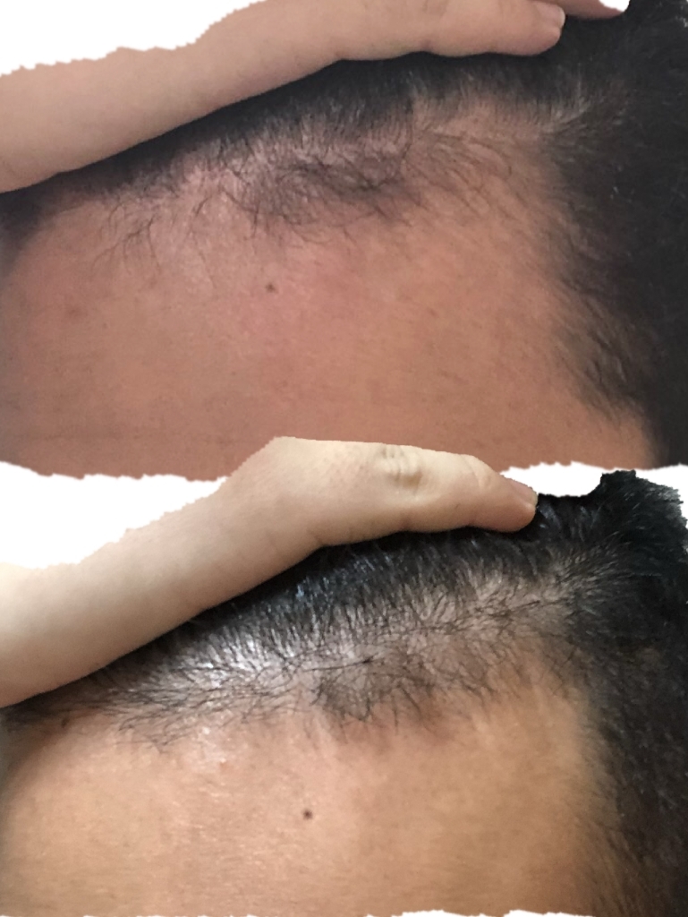 위에가 작년8월 밑에가 현재