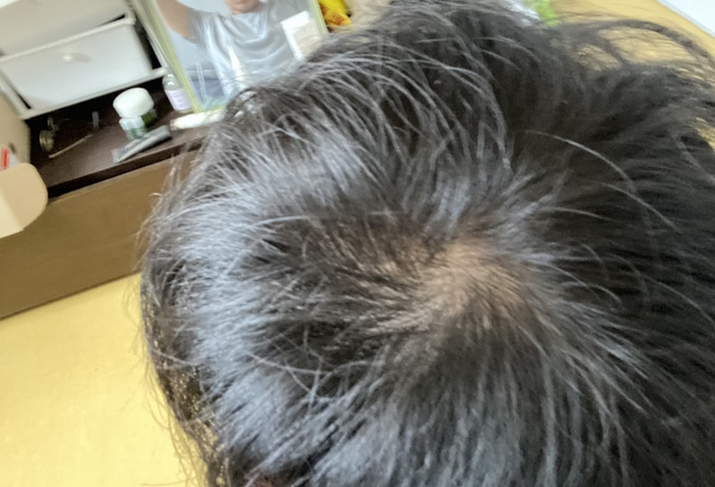 47D040E7-9C9E-4FFB-AAEA-2A16F335C763.jpeg