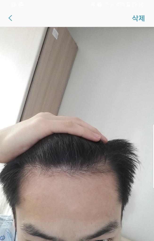 20180802_154419.jpg