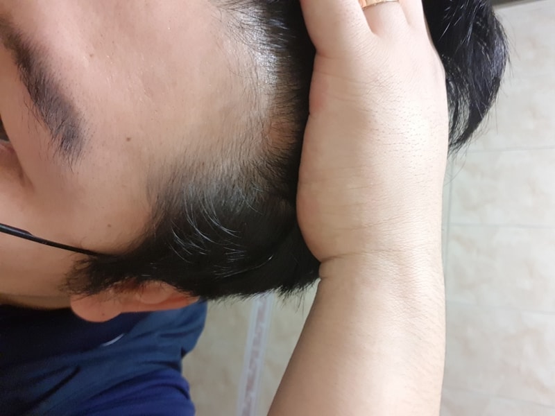 20180915_071540.jpg
