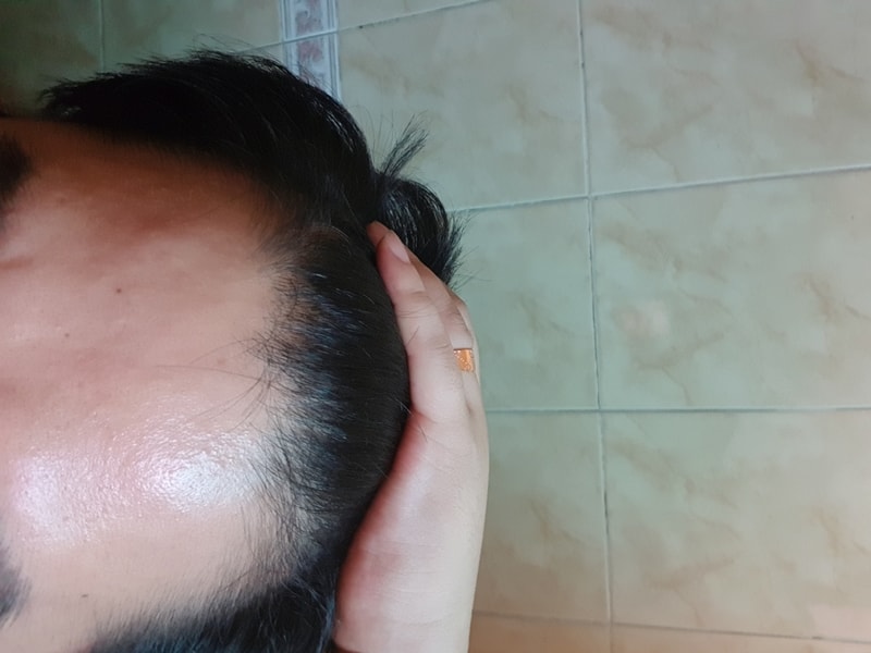 20180915_071634.jpg