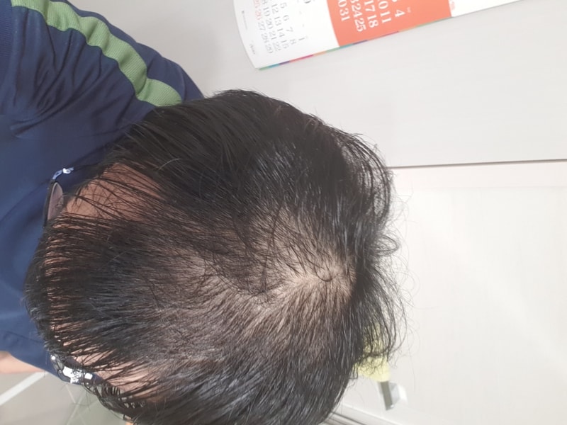 20180717_105227.jpg