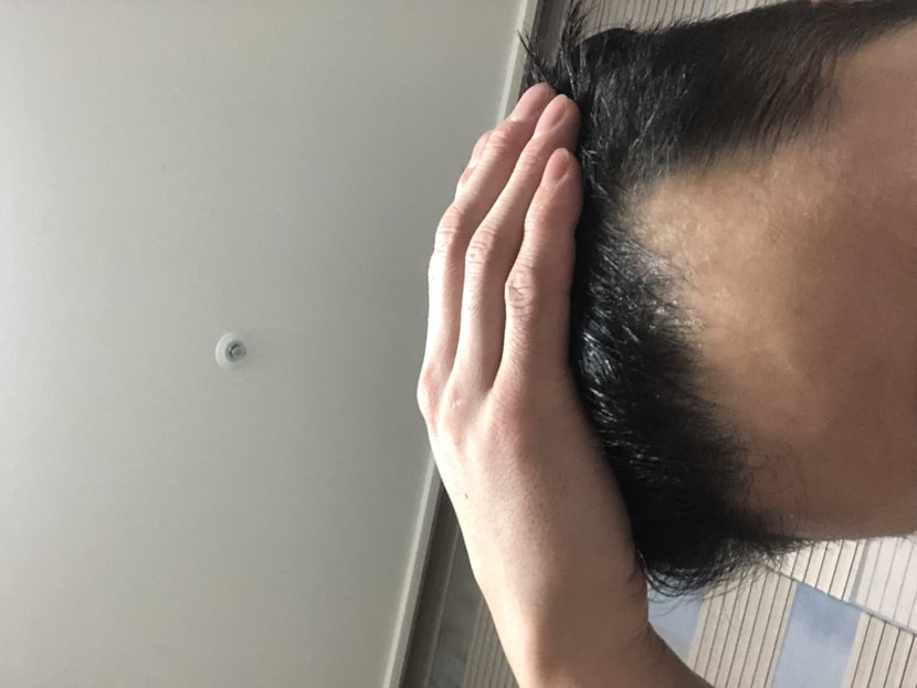 왼쪽