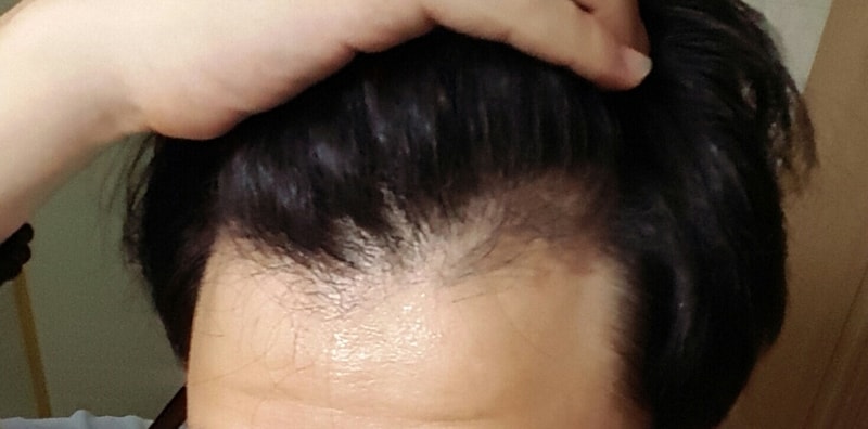 20160803_201833.jpg