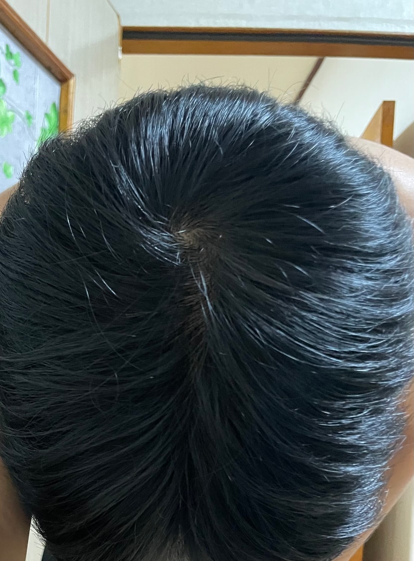 고개 숙여서 찍었습니다