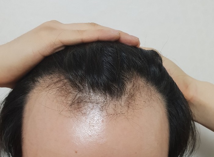 호영.jpg