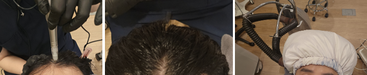 탈모2.png