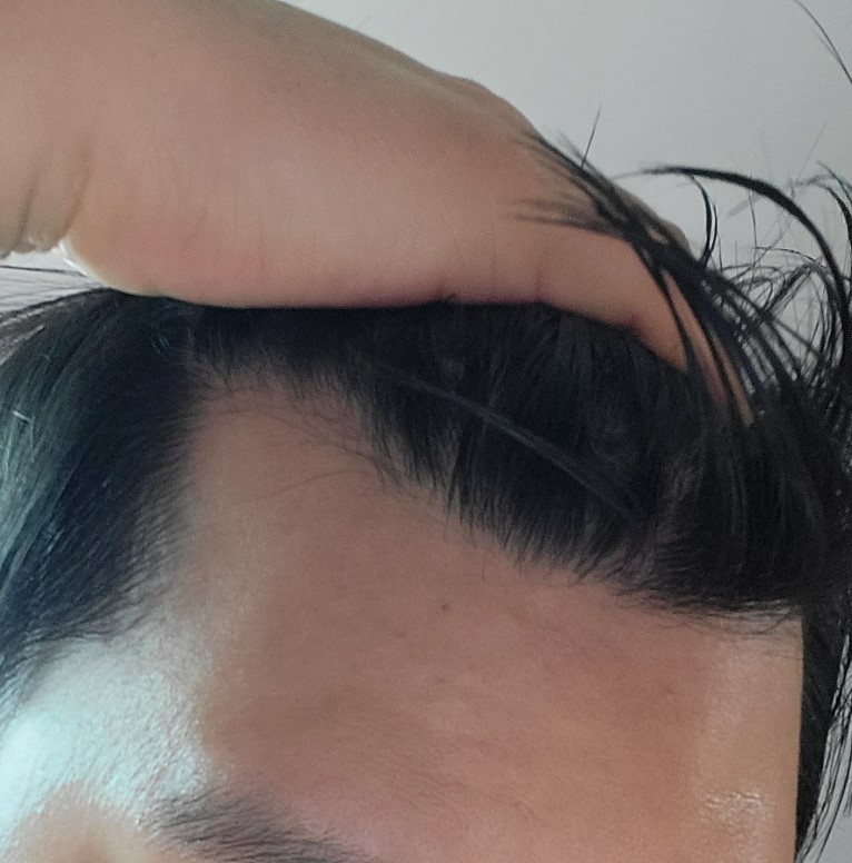 이마3.jpg