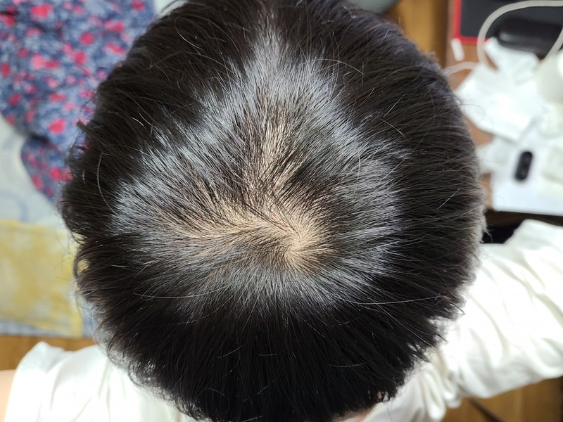 20201121_204133.jpg
