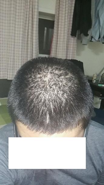 2014_피나재복용1년.JPG