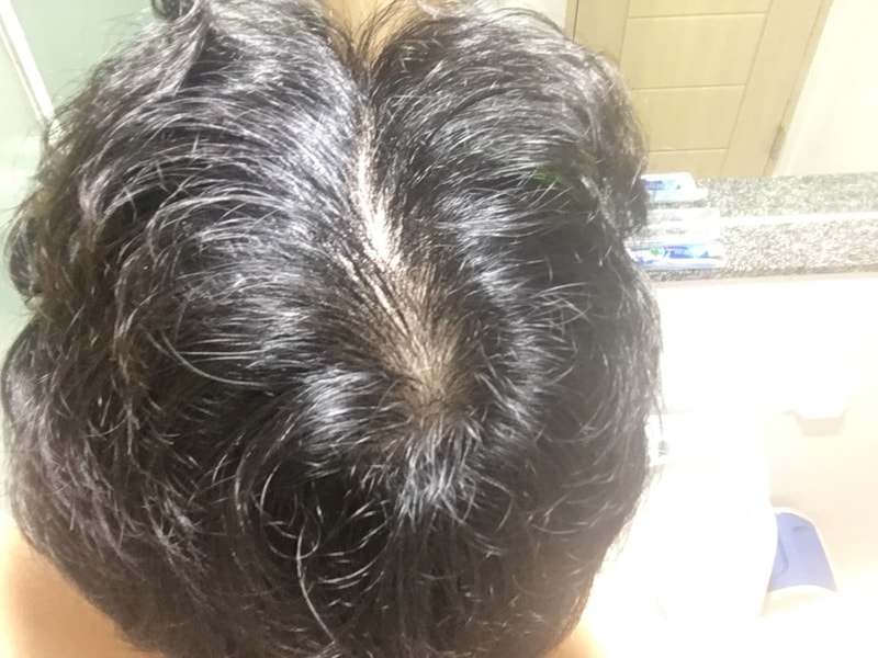 복용후1.JPG