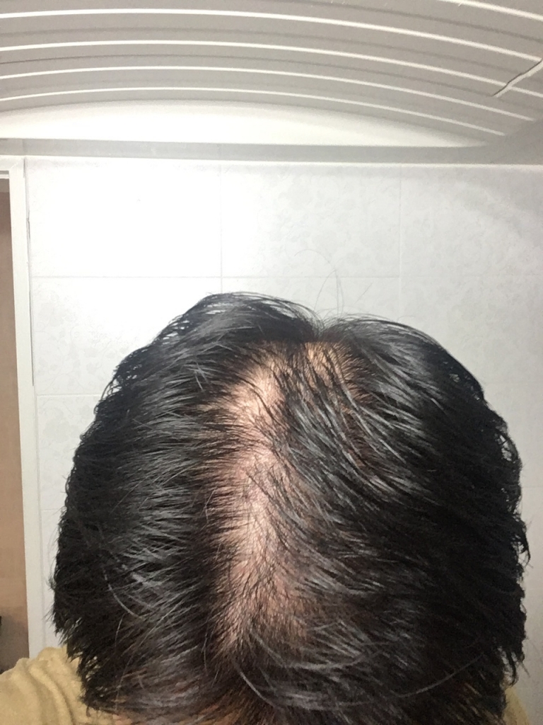 KakaoTalk_20170914_181716086.jpg