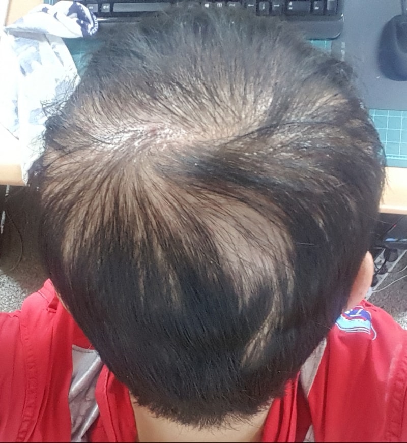 20170716_203635[1].jpg