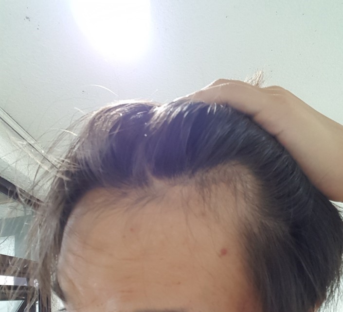 우1.jpg