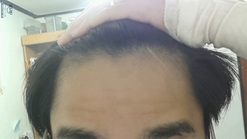 회전_11개월.jpg