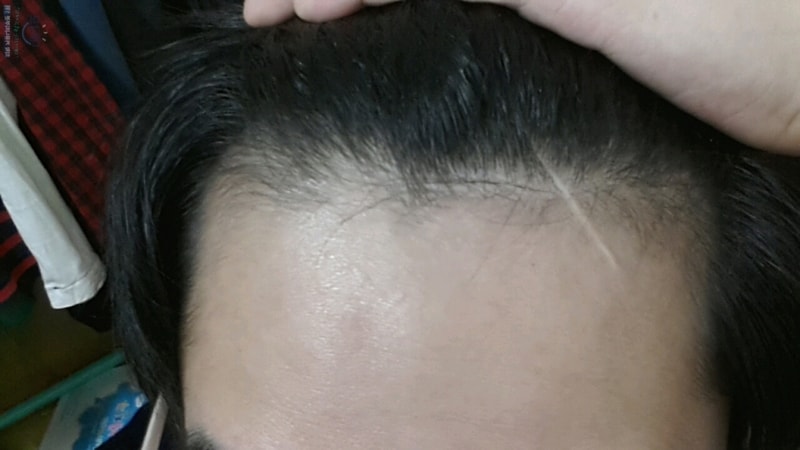 회전_74dae36960c613de7c78eace66b374f8.jpg