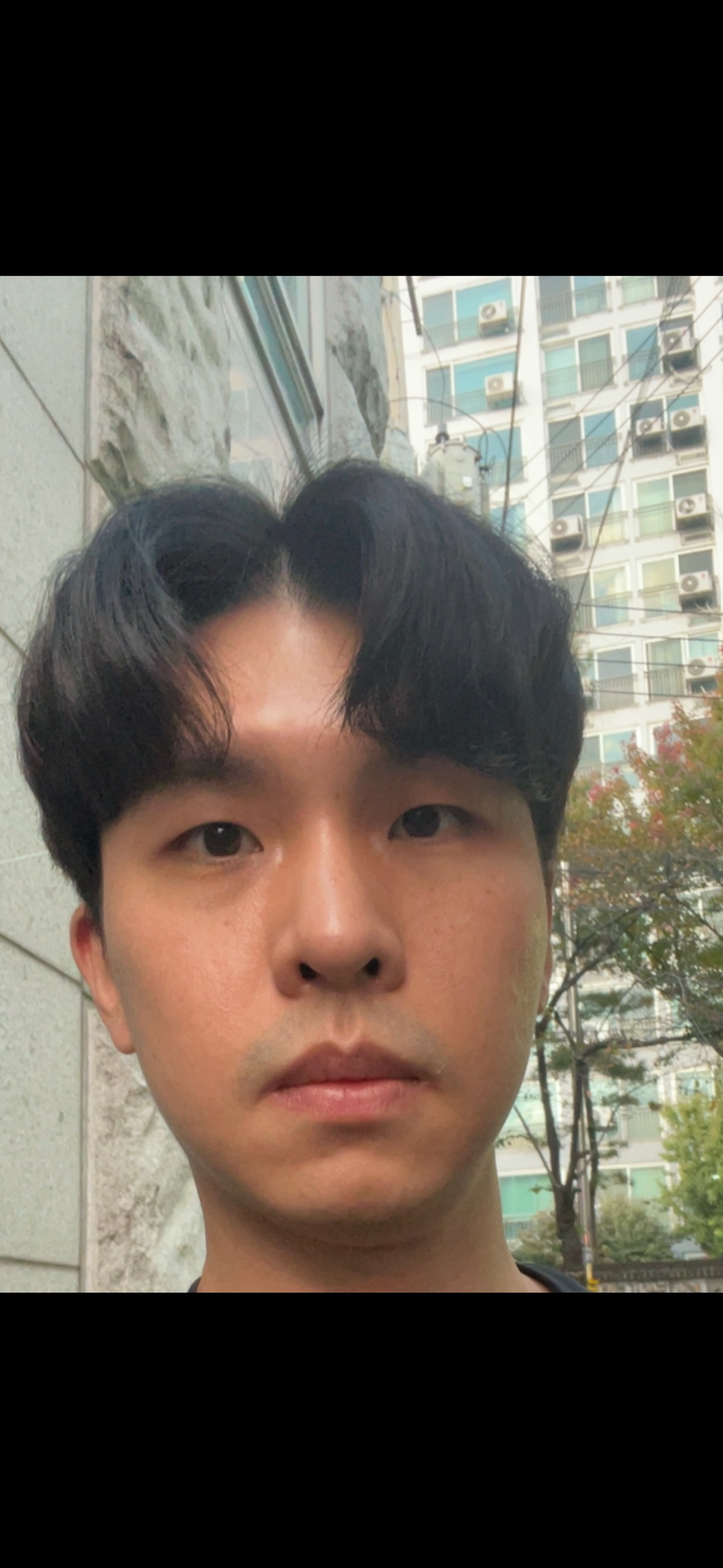 저도 탈모일까요??