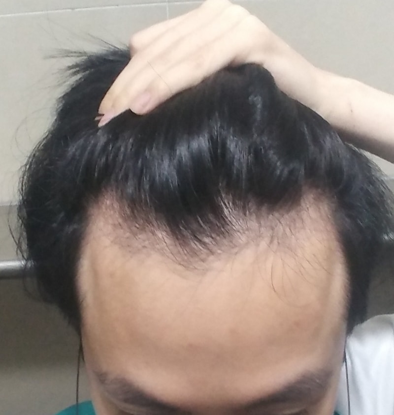 20180608_081336~2.jpg