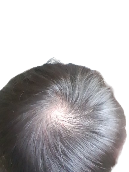 20241007_124327-removebg-preview.png