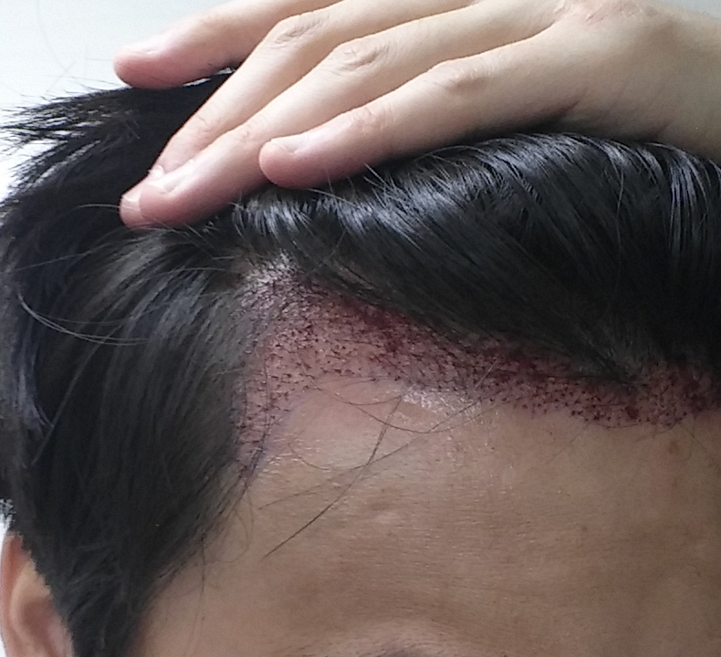 20151107_201428.jpg