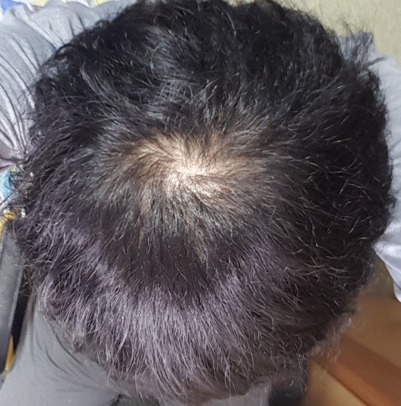 20170416_151755.jpg