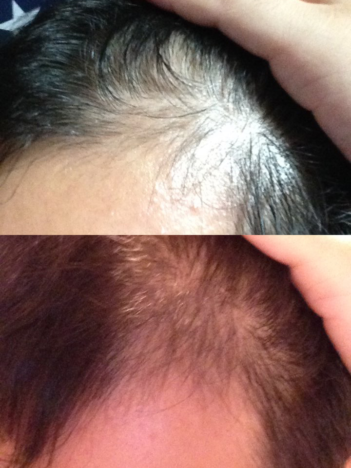 10-18~11-08
