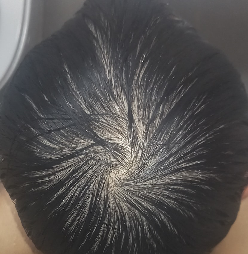 물적신후