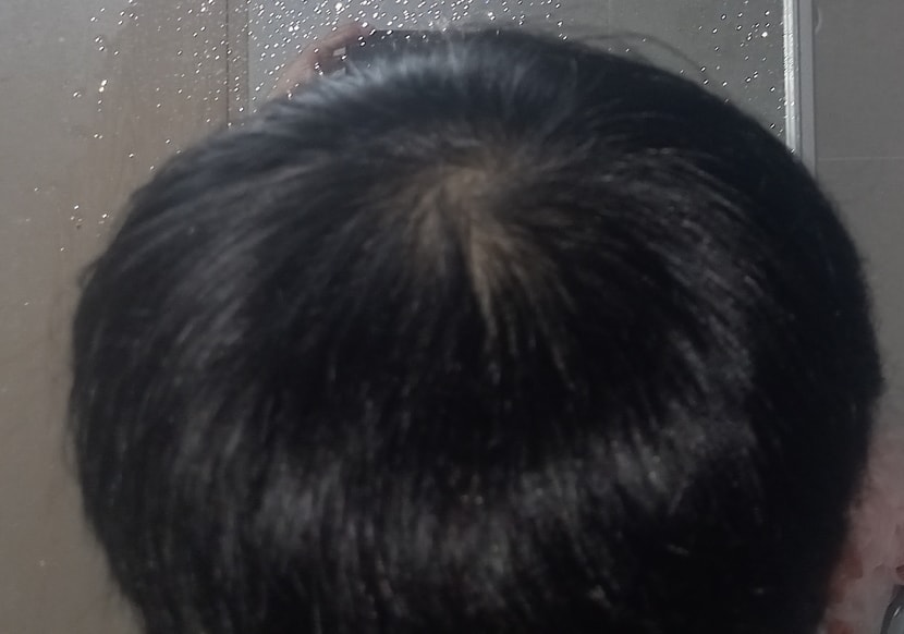 뒤에서