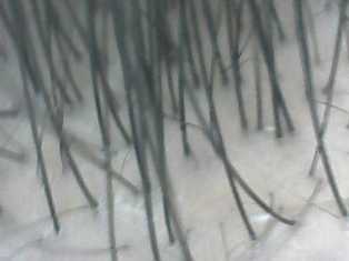 Hair line.jpg