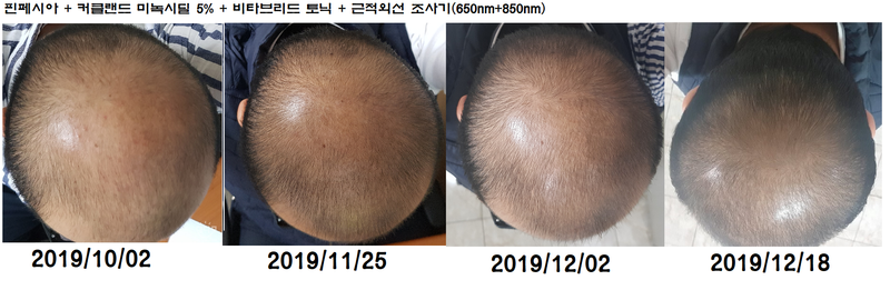 종합2.png