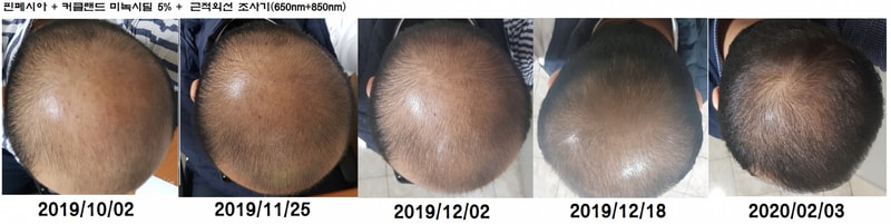 종합3_3.5개월째.png