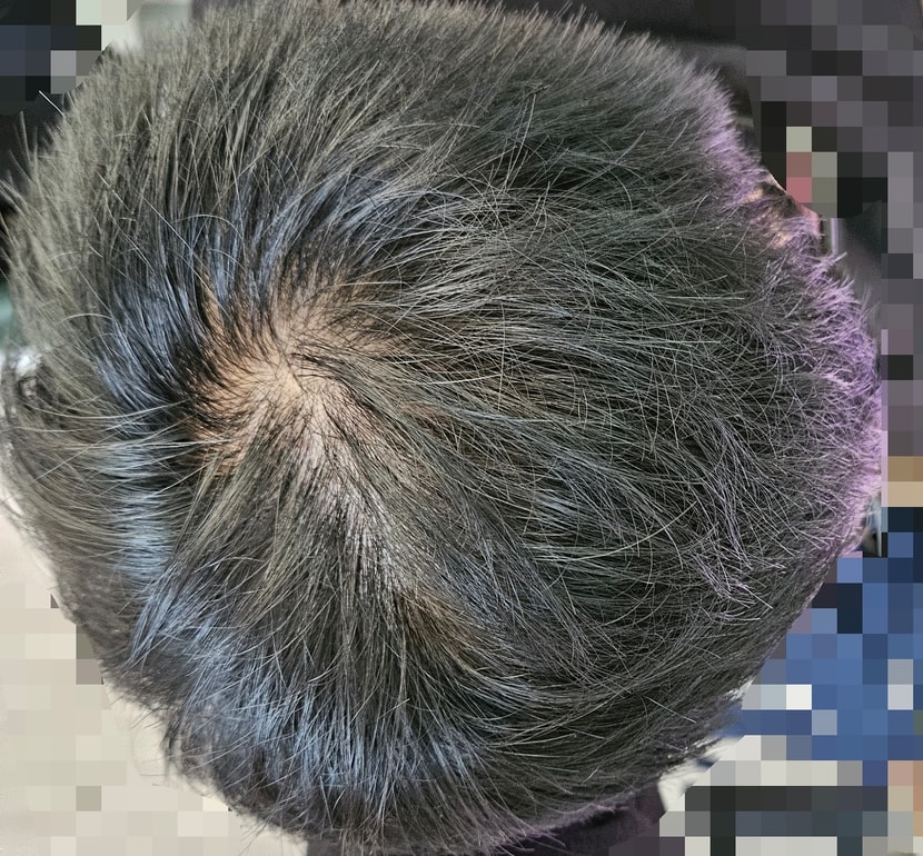 정수리 