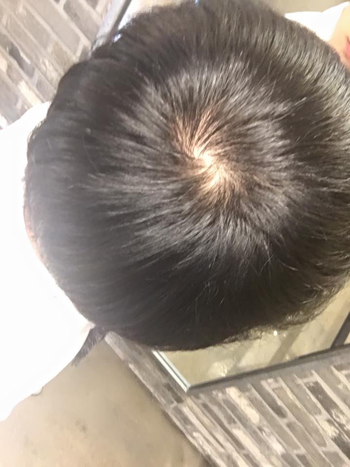 남자정수리 기준 .jpg