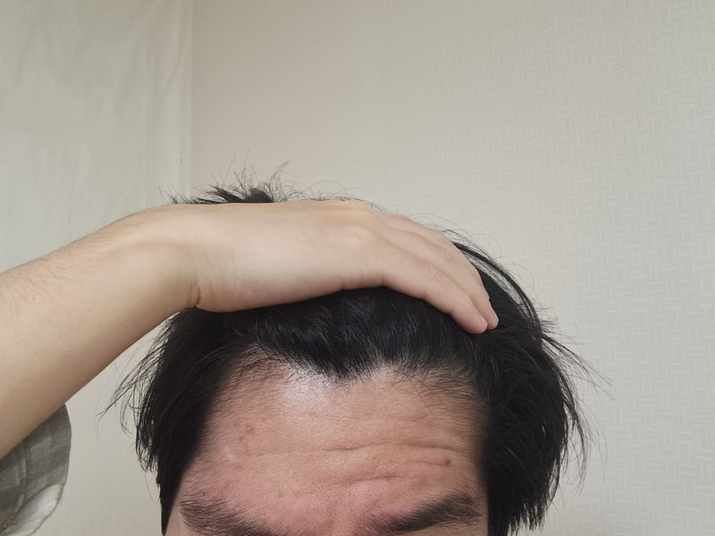 1000013194.jpg