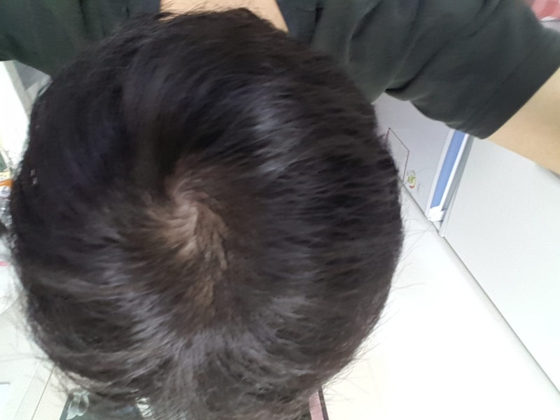 20170321_214001.jpg