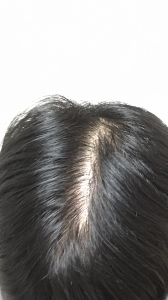 037E1D7E-9D82-4B24-BC30-B08680E4C047.png