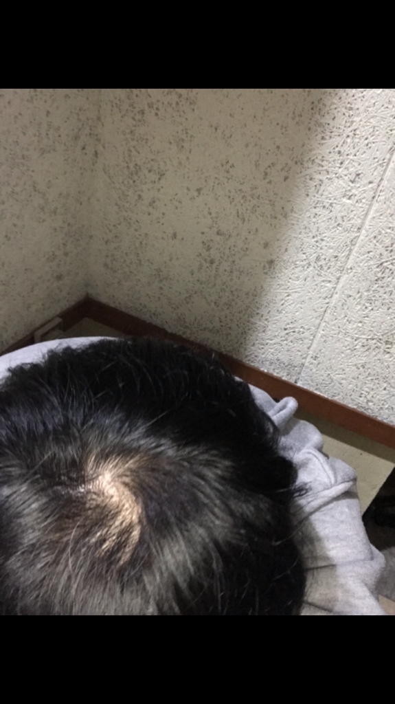 88D2B33F-BF6B-4926-BF95-212380EB7681.png