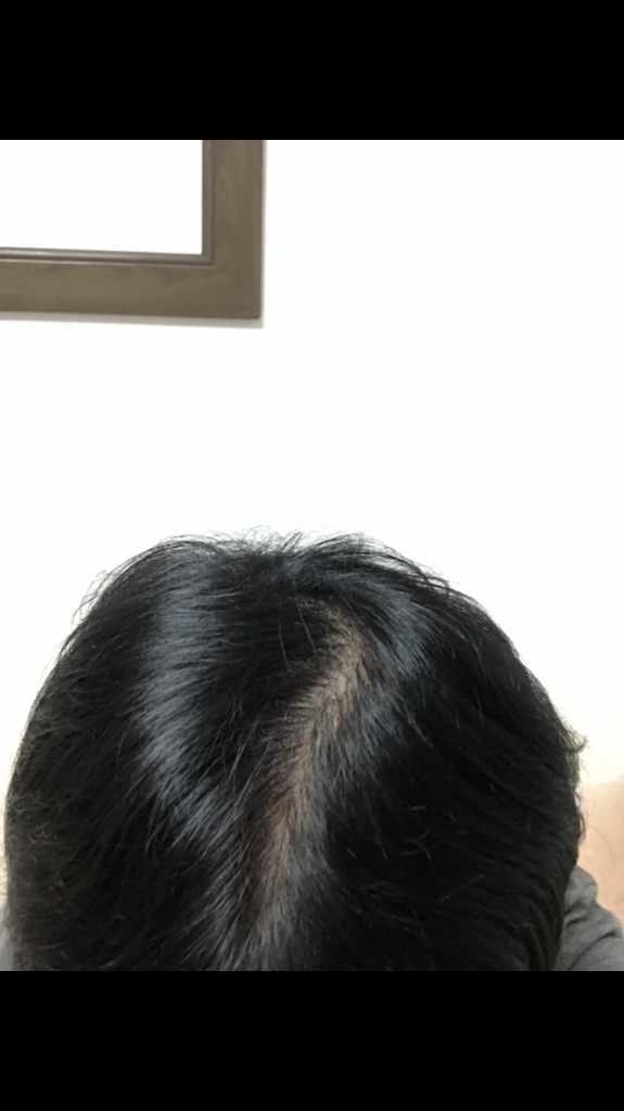 562A6096-FE39-40C2-B538-82CF061D1E16.png