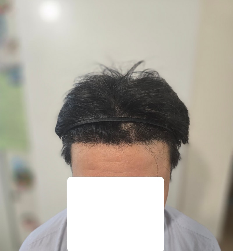 수술 후 3.jpg