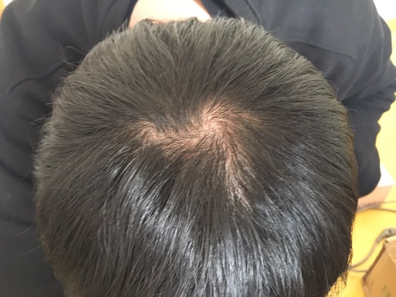 KakaoTalk_20170228_131302773.jpg
