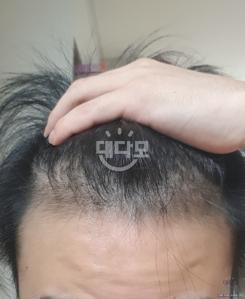 2달차M.jpg