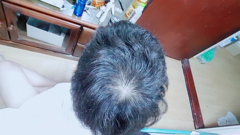 B612_20170717_174917.jpg