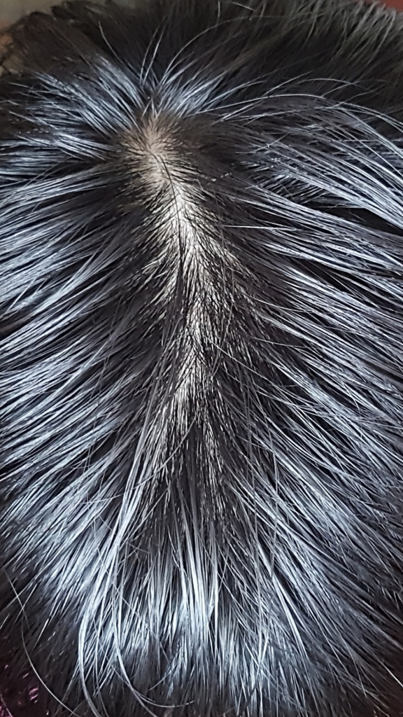 Screenshot_20190306-110936_Gallery.jpg
