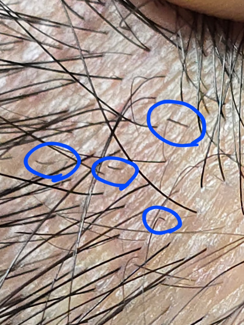 신생모가 자라고 있는 걸까요??
