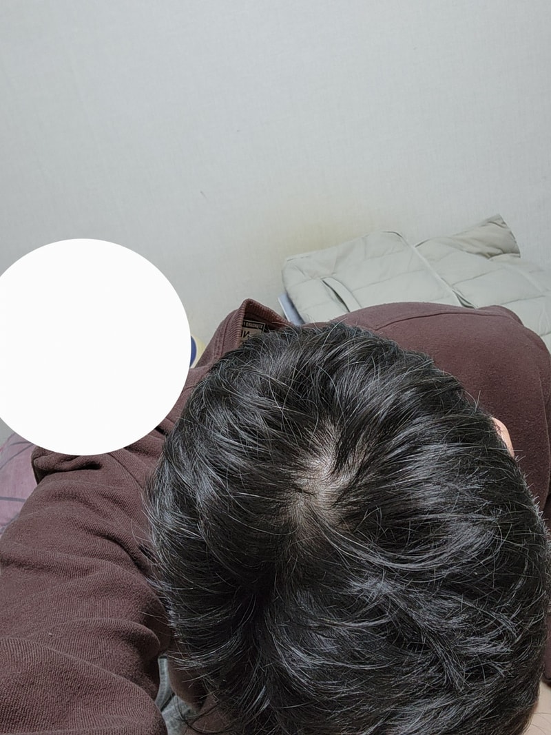 50대초반 아보다트