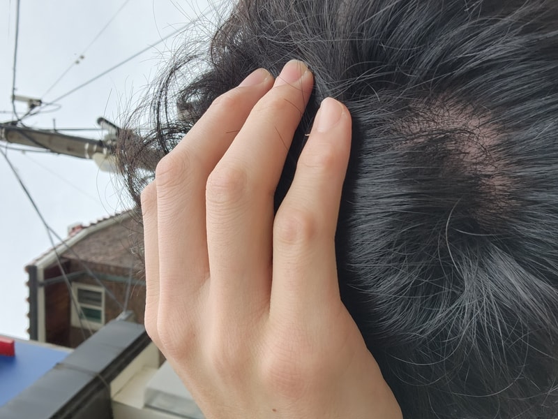 1000001179.jpg