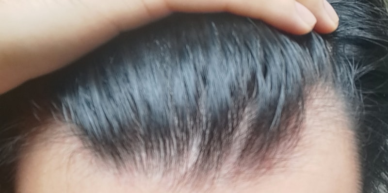 1000000735.jpg