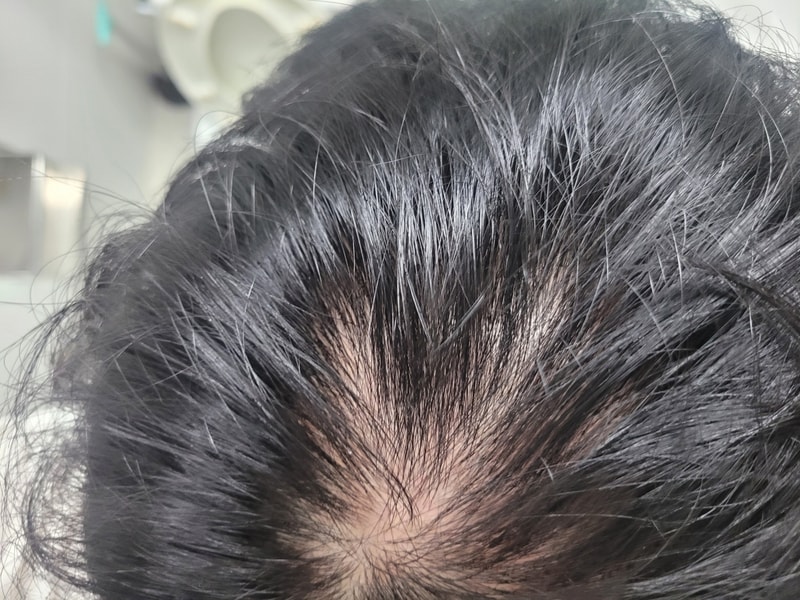 KakaoTalk_20241118_192917863_04.jpg
